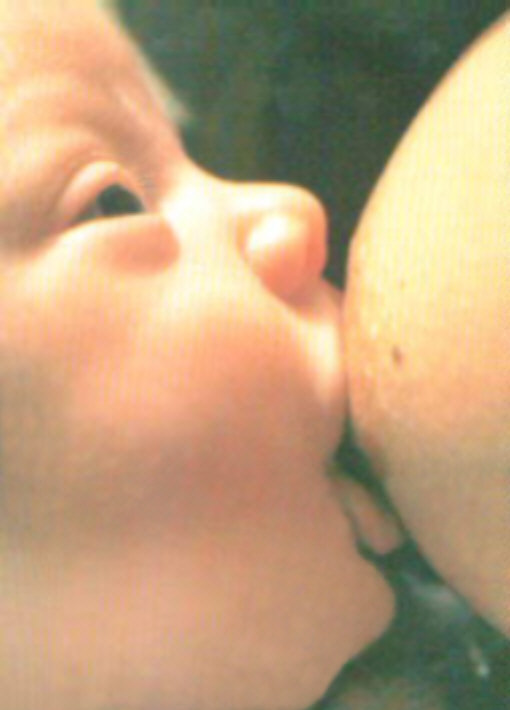 A baby suckling at the breast.