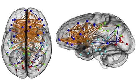 Neural traffic in the typical female brain