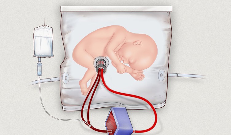 The artificial womb Anglin envisages as the solution to female vapidity